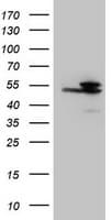 IDH1 / IDH Antibody (clone OTI24A2)