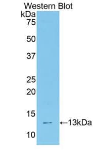 TCF20 Antibody (aa1871-1965, FITC)