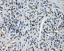 KIAA0153 / TTLL12 Antibody (clone OTI1A2)