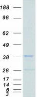 Human PRKRA / PACT Protein (Recombinant Myc-DDK (Flag))