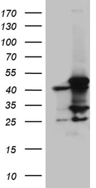 MCAD / ACADM Antibody (clone OTI2G7)