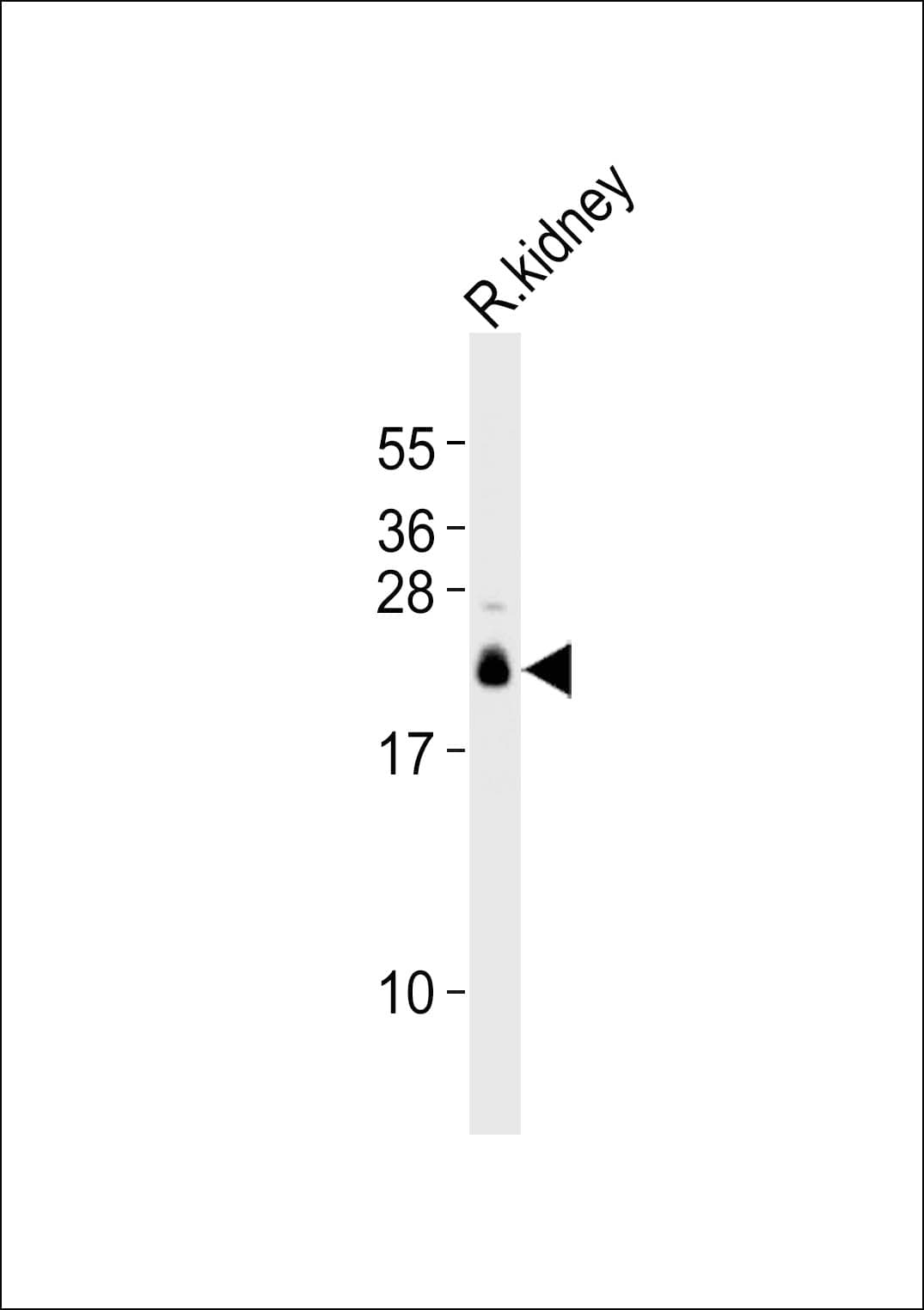 CLDN10 / Claudin 10 Antibody