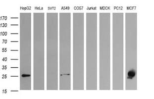 LGALS3 / Galectin 3 Antibody (clone OTI1A3)