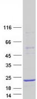 Human CALML4 Protein (Recombinant Myc-DDK (Flag))