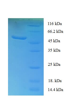 Human USAG1 / SOSTDC1 Protein (Recombinant GST)