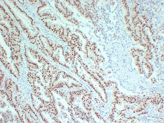 PathPlus™ Monoclonal Mouse anti-Human SOX9 Antibody (IHC, WB)