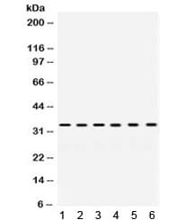 SULT2A1 / Sulfotransferase 2A1 Antibody