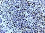 Polyclonal Rabbit anti-Human CASP3 / Caspase 3 Antibody (IHC, WB)