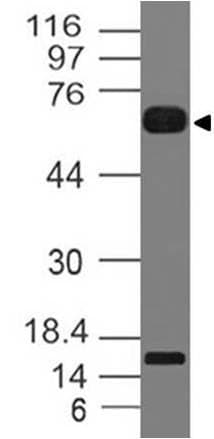 IL1RL2 Antibody