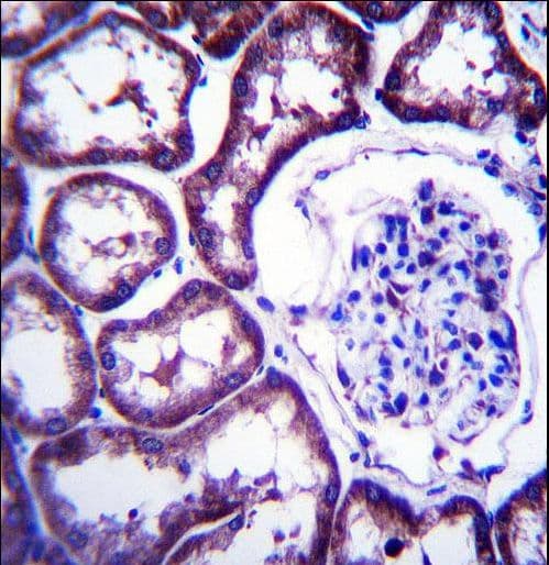 Polyclonal Rabbit anti-Human Disulfide Isomerase / TXNDC15 Antibody (aa257-285, IHC, WB)