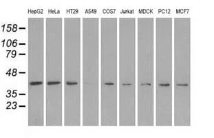 Monoclonal Mouse anti-Human MAPK1 / ERK2 Antibody (clone OTI4C2, IHC, IF, WB)