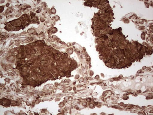 MTDH / Metadherin Antibody (aa70-582, clone OTI6H2)