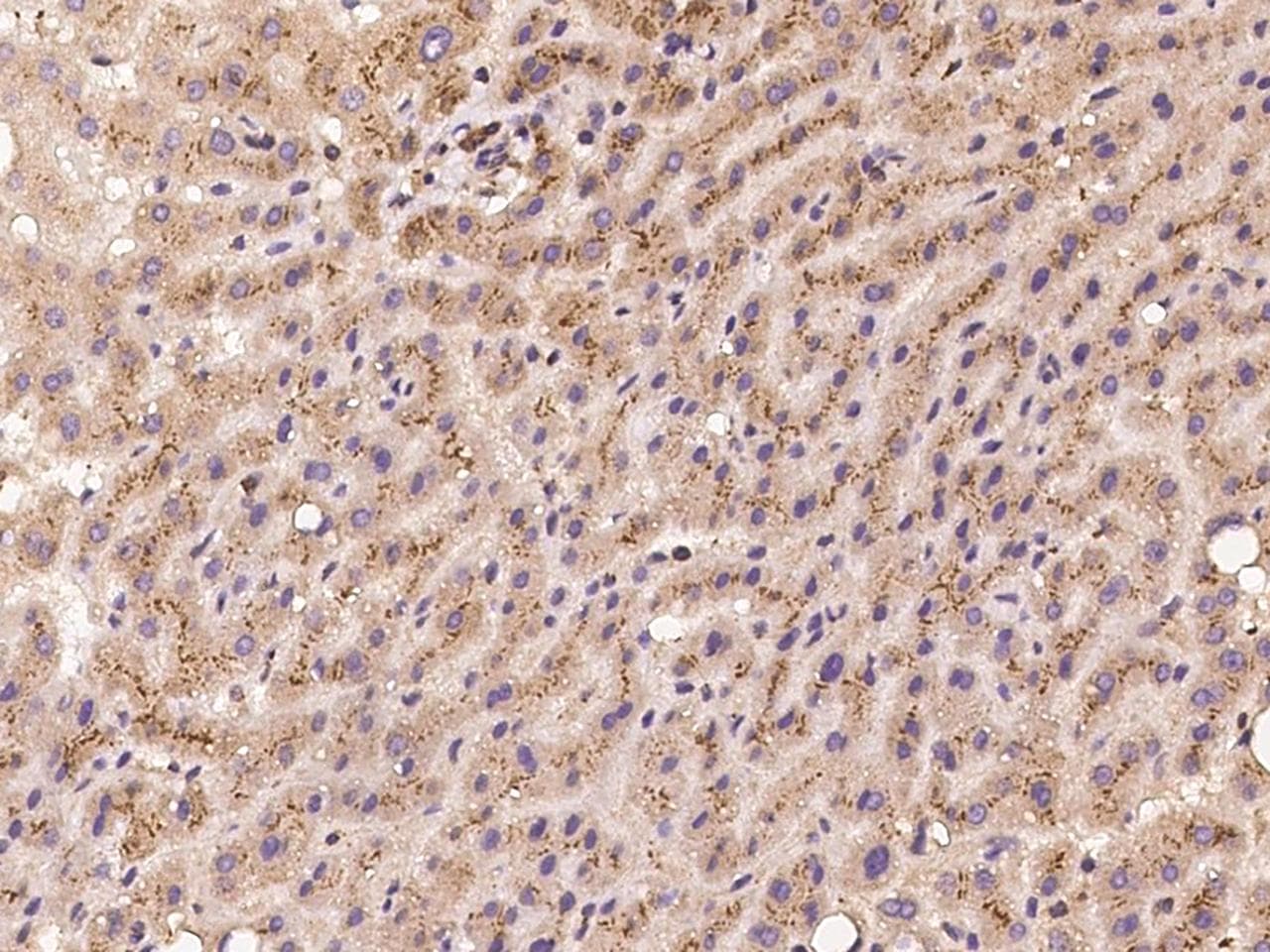 Polyclonal Rabbit anti-Human RBCK1 Antibody (IHC)