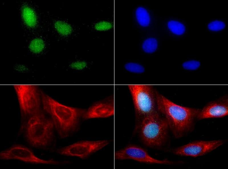 PathPlus™ RBFOX3 / NEUN Antibody