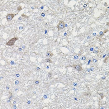 CDH23 / Cadherin 23 Antibody