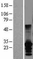 CT45A2 Protein (Over-Expression Lysate Myc-DDK (Flag))