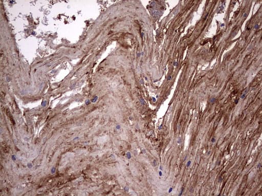 KRT7 / CK7 / Cytokeratin 7 Antibody (clone OTI2A2)
