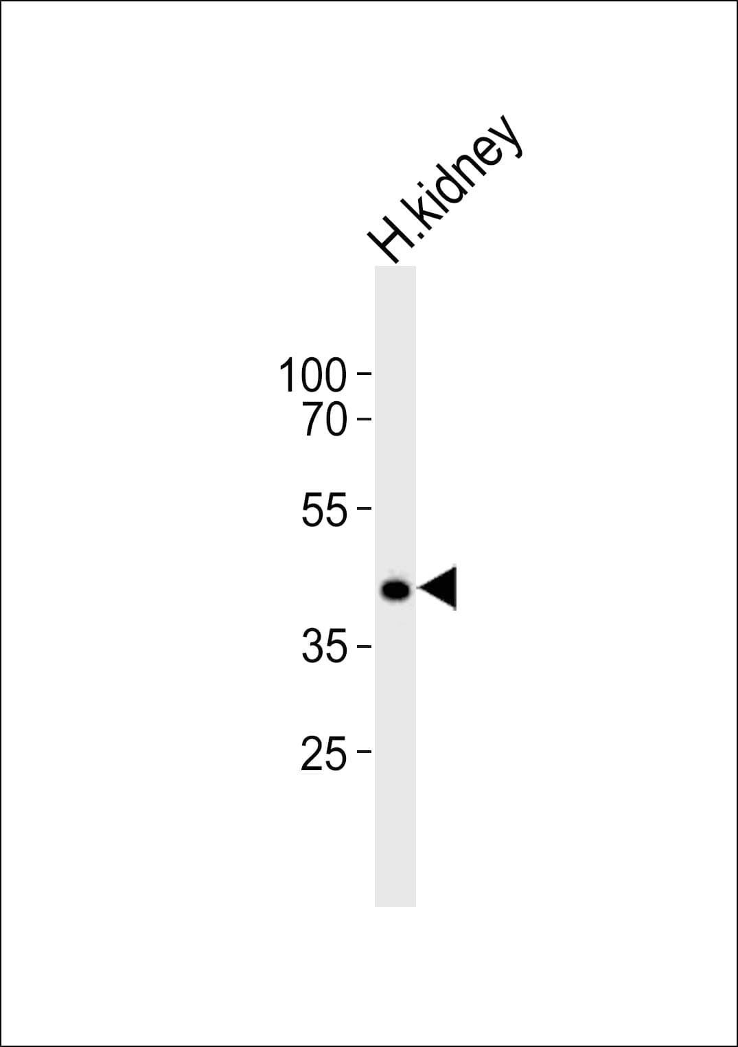 Polyclonal Rabbit anti-Human PCGF6 Antibody (aa261-295, WB)