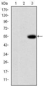 MMP9 / Gelatinase B Antibody (clone 5G3)