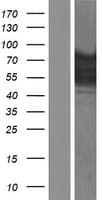 EWSR1 / EWS Protein (Over-Expression Lysate Myc-DDK (Flag))
