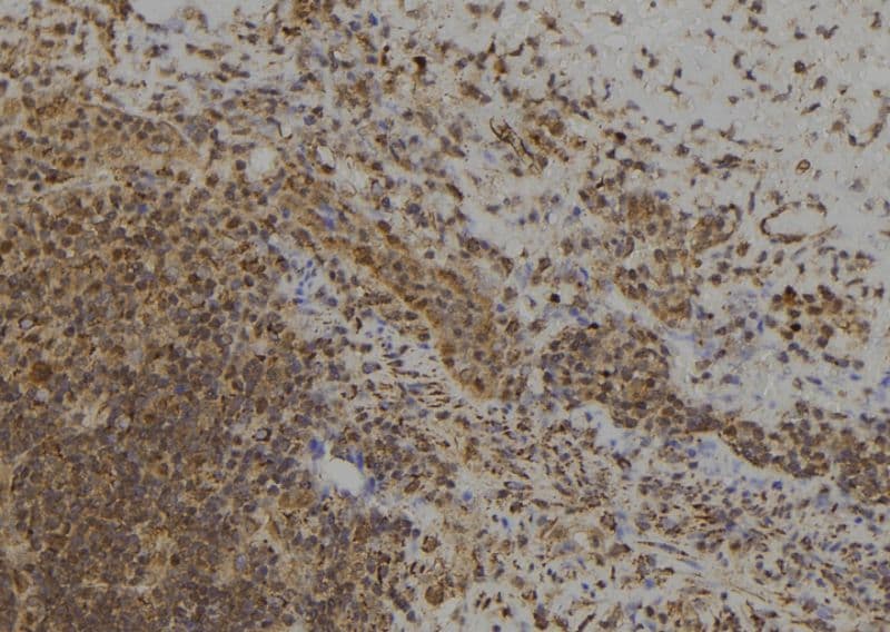 MAGED4 Antibody