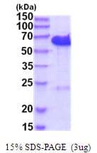 Human CDK5RAP3 Protein (Recombinant His)