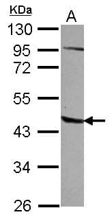 AGPAT5 Antibody