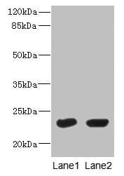 UBE2T / HSPC150 Antibody