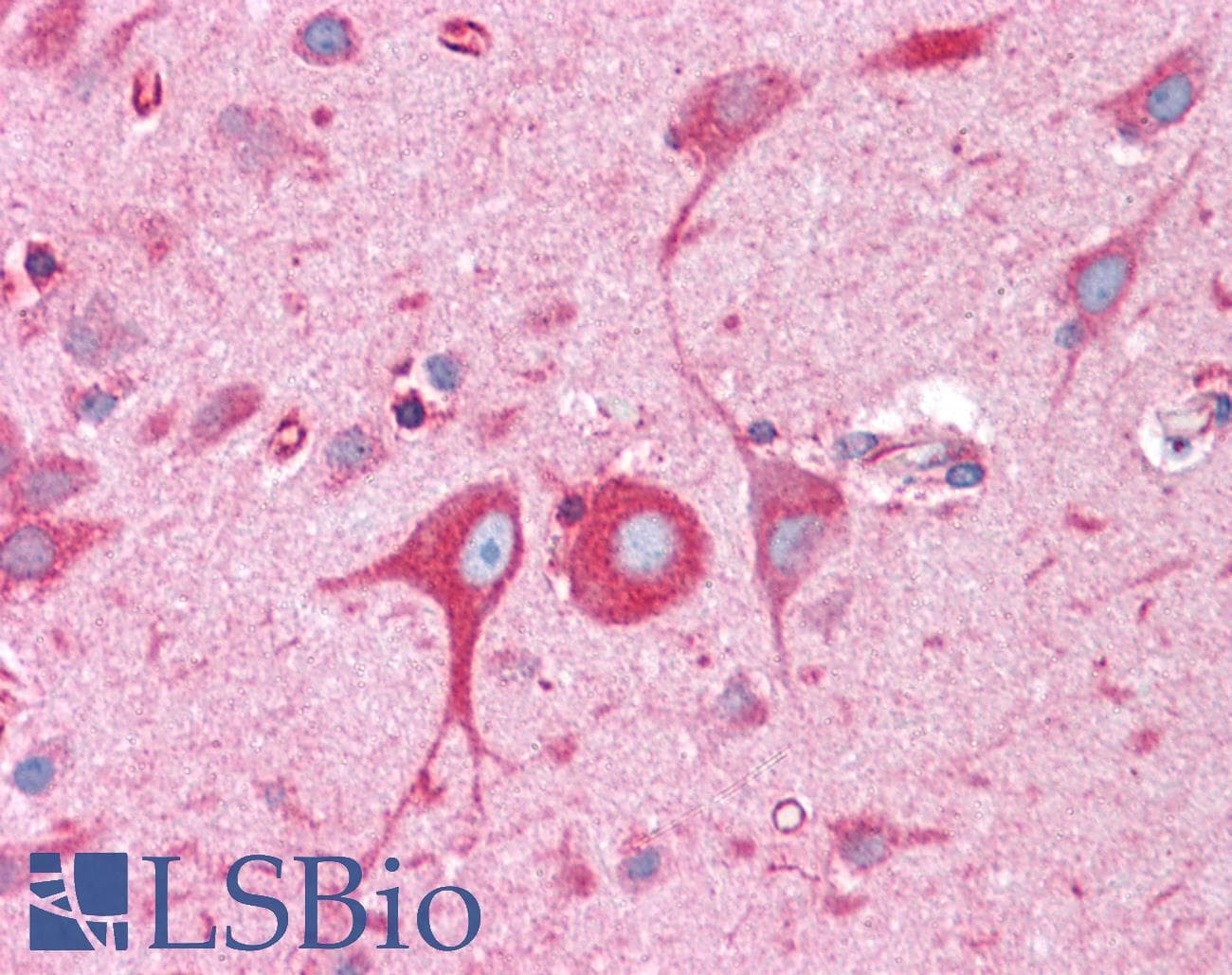 IHC-plus™ BCAP31 / BAP31 Antibody (aa301-313)