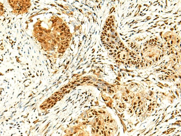 POLR3F Antibody