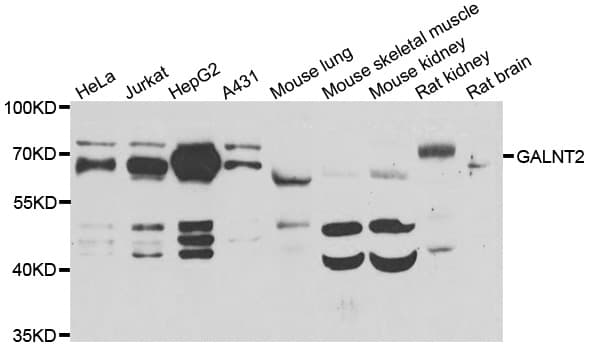 Polyclonal Rabbit anti-Human GALNT2 Antibody (IHC, IF, WB)