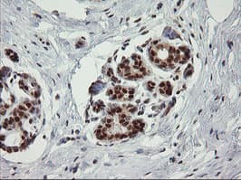 TRMT2A Antibody (clone OTI1H8, Carrier-free)