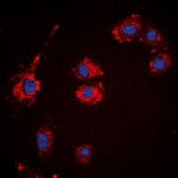 KIAA0100 / BCOX Antibody (Internal)