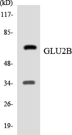 Polyclonal Rabbit anti-Human PRKCSH Antibody (aa68-117, WB)