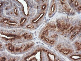 PIK3CG / PI3K Gamma Antibody (clone OTI4B9)
