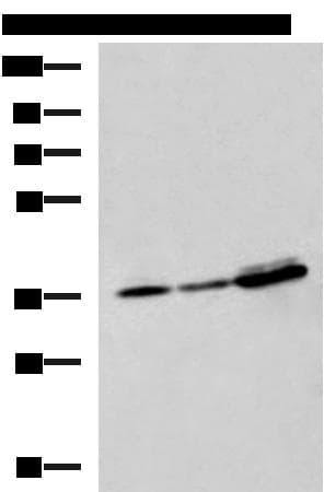 Polyclonal Rabbit anti-Human EEF1D Antibody (IHC, WB)