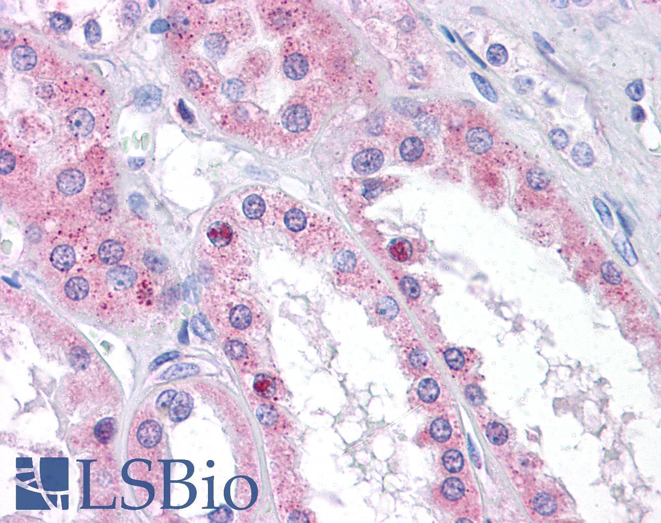 IHC-plus™ CTMP / THEM4 Antibody