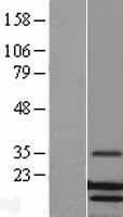 LYZ / Lysozyme Protein (Over-Expression Lysate Myc-DDK (Flag))