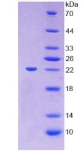 Mouse LCAT Protein (Native His, N-Terminal)
