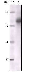 Pan Cytokeratin Antibody (clone 7H8C4)