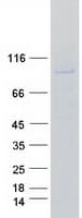 Human BCAR3 Protein (Recombinant Myc-DDK (Flag))