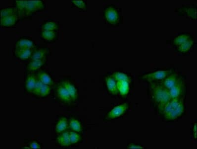 VAMP7 / SYBL1 / T1 VAMP Antibody