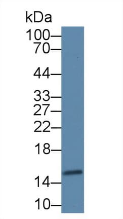 FABP4 / AP2 Antibody (aa1-125, Biotin)