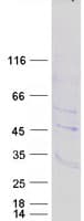 Human PTOV1 Protein (Recombinant Myc-DDK (Flag))