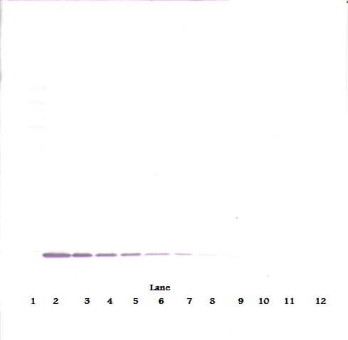 CSF2 / GM-CSF Antibody (Biotin)