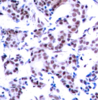 JUNB / JUN-B Antibody (phospho-Ser259)