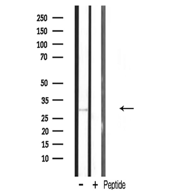 MRPL10 Antibody