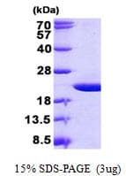 Human OMP Protein (Recombinant His)