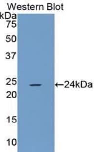 SMAD2 Antibody (aa273-467)