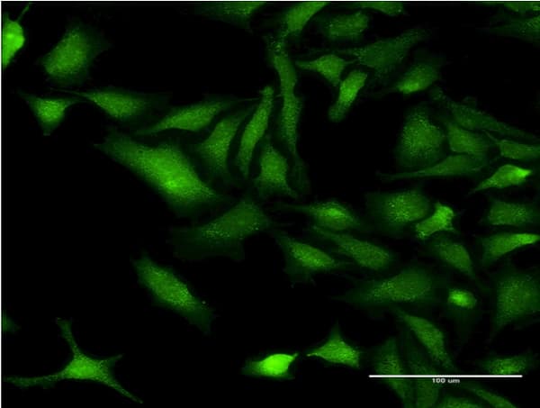 CHRNB3 Antibody (clone 3G6)